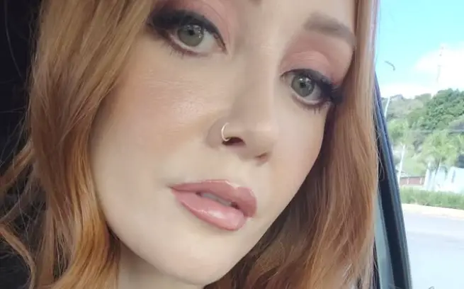 Lábios perfeitos com Lip Lift