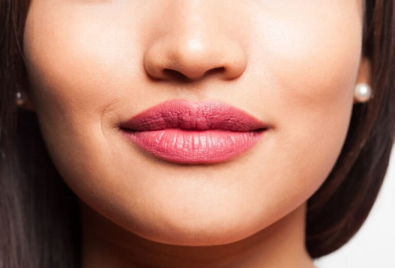 Preenchimento Labial em Porto Alegre: Naturalidade, Proporção e Harmonia Facial
